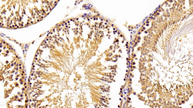 ACP1 Antibody in Immunohistochemistry (Paraffin) (IHC (P))