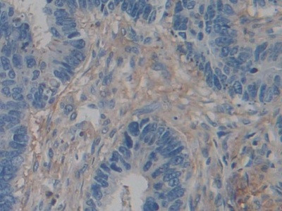 ACTG2 Antibody in Immunohistochemistry (Paraffin) (IHC (P))