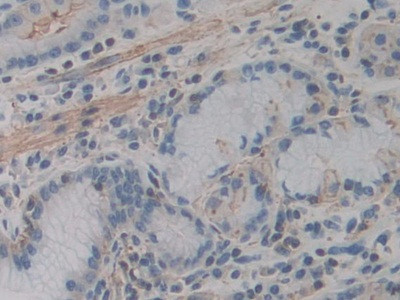 ACTG2 Antibody in Immunohistochemistry (Paraffin) (IHC (P))