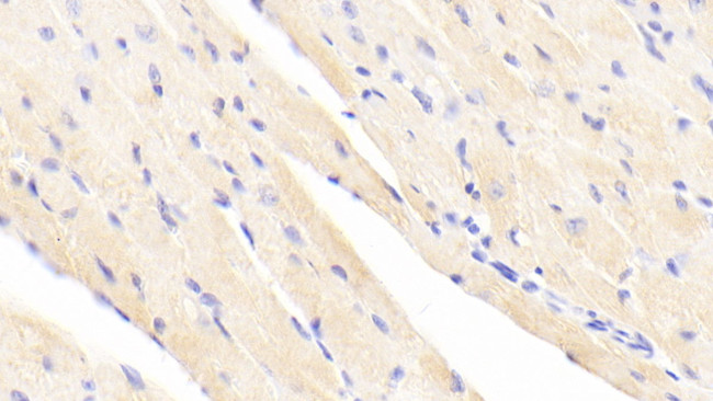 alpha Actinin 2 Antibody in Immunohistochemistry (Paraffin) (IHC (P))