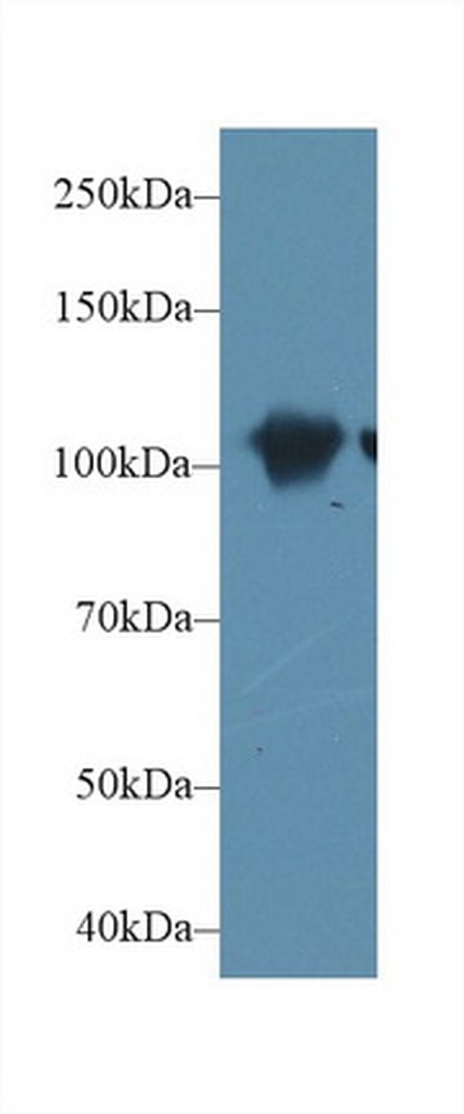 alpha Actinin 2 Antibody in Western Blot (WB)