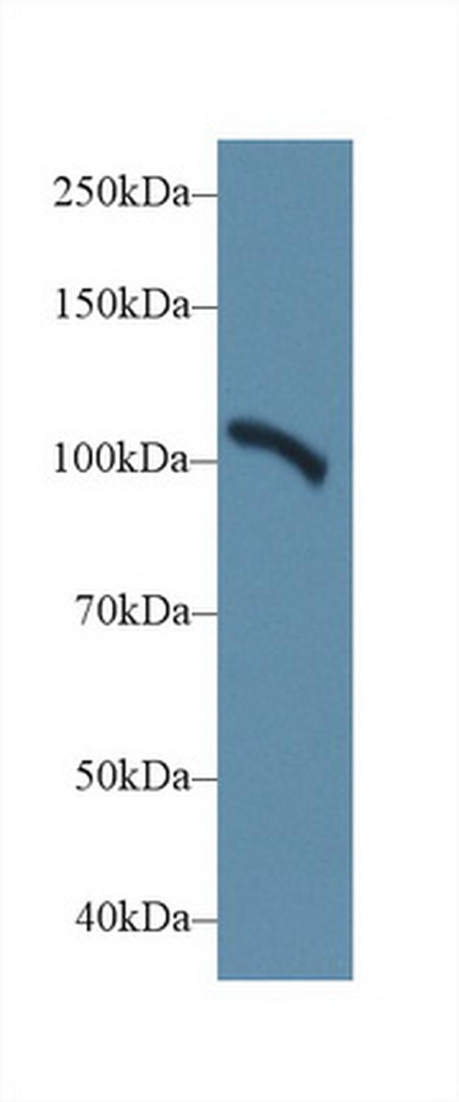 alpha Actinin 2 Antibody in Western Blot (WB)