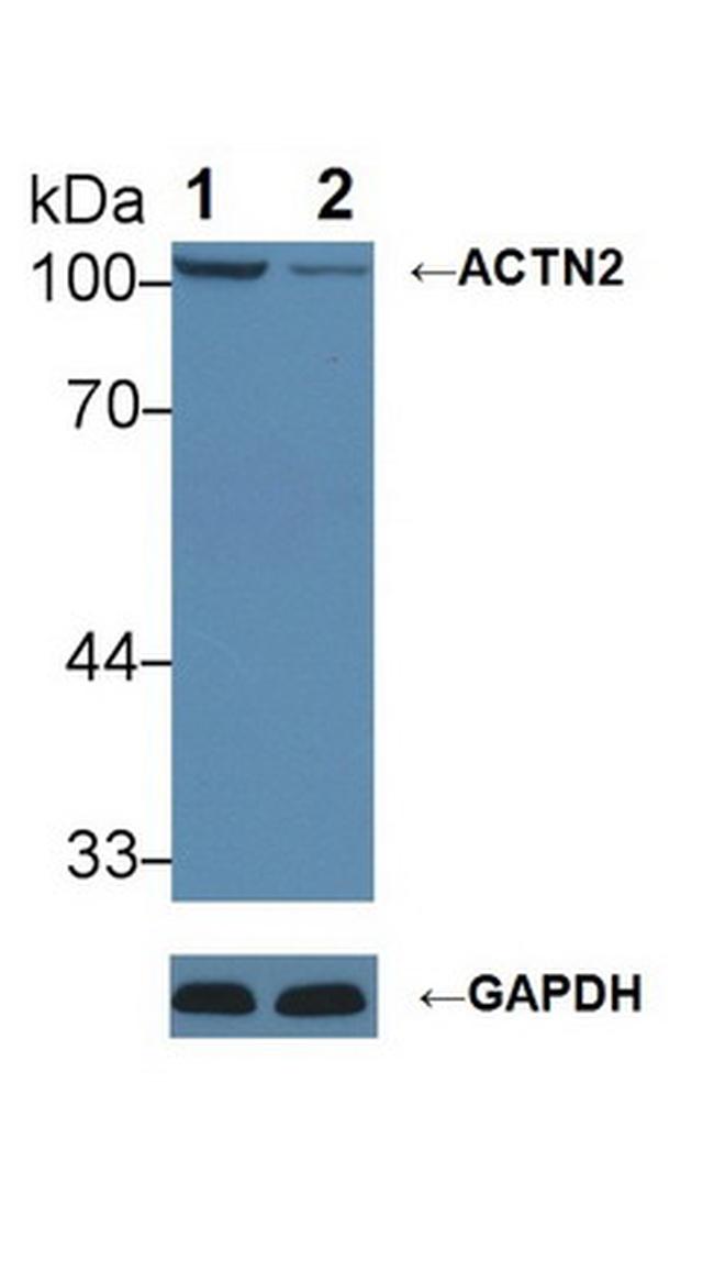 alpha Actinin 2 Antibody in Western Blot (WB)