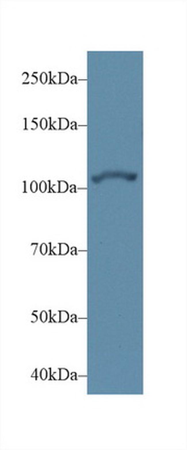 alpha Actinin 2 Antibody in Western Blot (WB)