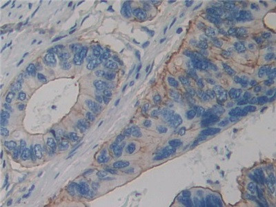 alpha Actinin 4 Antibody in Immunohistochemistry (Paraffin) (IHC (P))