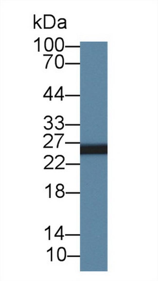 AK3 Antibody in Western Blot (WB)