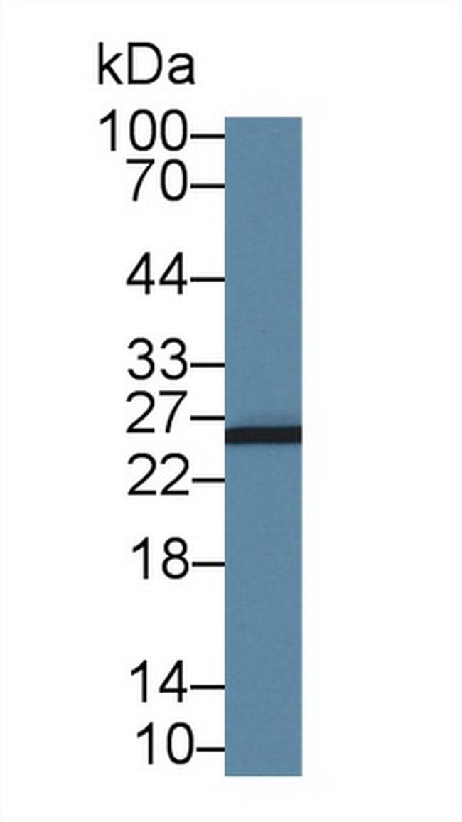 AK3 Antibody in Western Blot (WB)