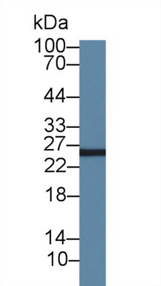 AK3 Antibody in Western Blot (WB)