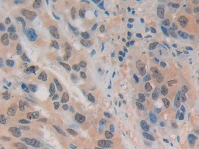 ADRM1 Antibody in Immunohistochemistry (Paraffin) (IHC (P))