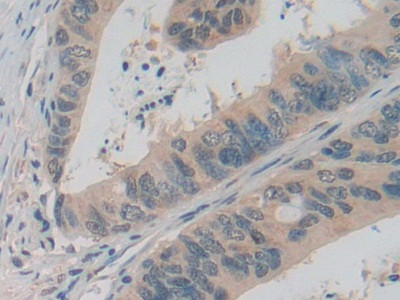 ADRM1 Antibody in Immunohistochemistry (Paraffin) (IHC (P))