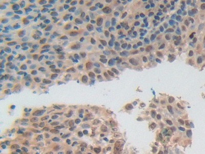 ADRM1 Antibody in Immunohistochemistry (Paraffin) (IHC (P))