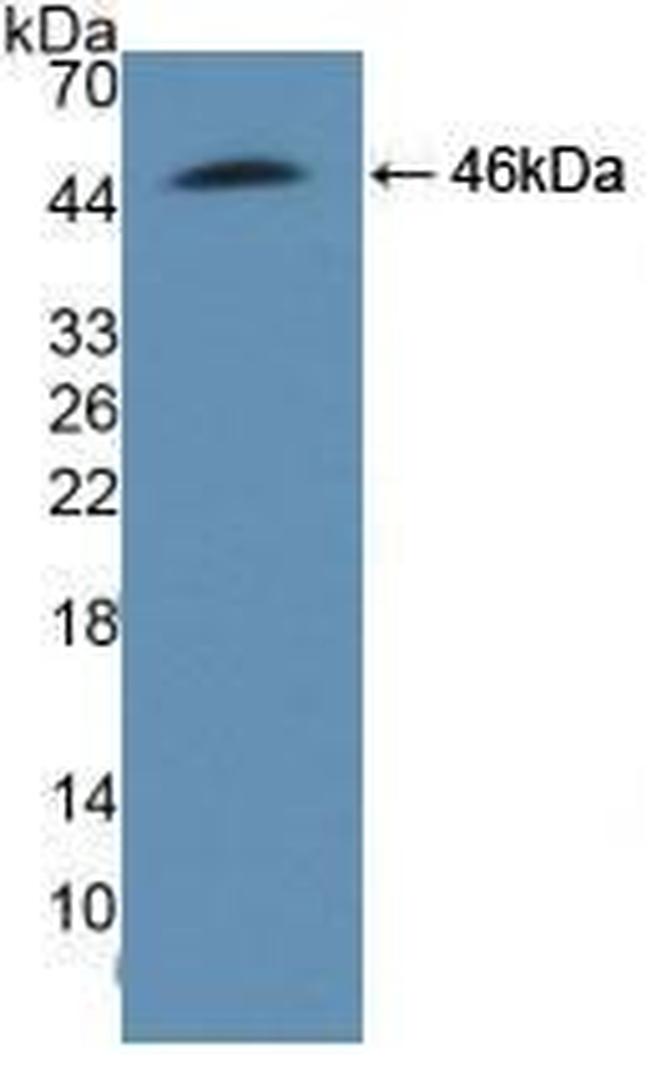 ADRM1 Antibody in Western Blot (WB)