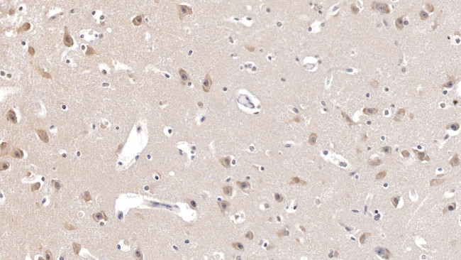 AgRP Antibody in Immunohistochemistry (Paraffin) (IHC (P))