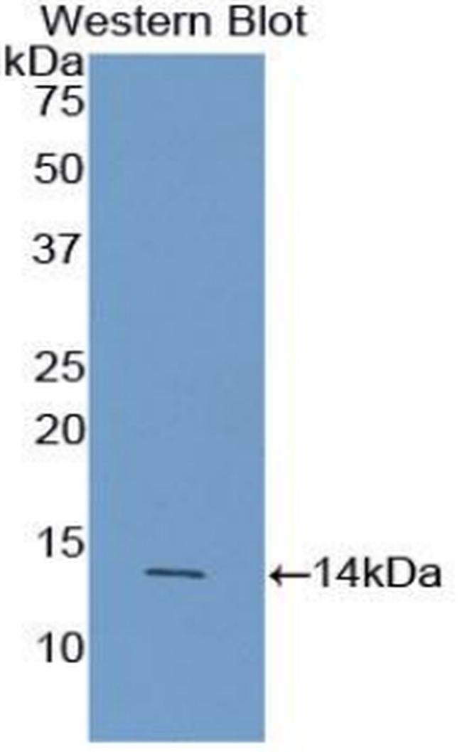 AgRP Antibody in Western Blot (WB)