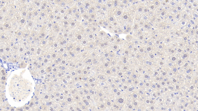 Alcohol Dehydrogenase 1A Antibody in Immunohistochemistry (Paraffin) (IHC (P))