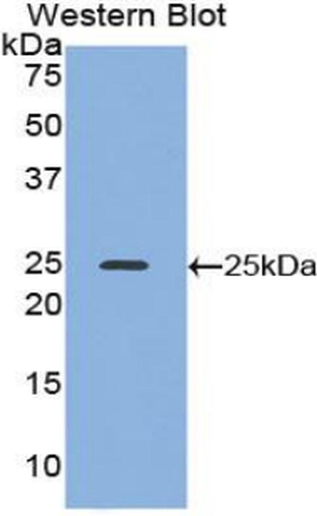 Alcohol Dehydrogenase 1A Antibody in Western Blot (WB)