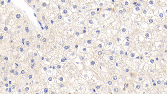 AFP Antibody in Immunohistochemistry (Paraffin) (IHC (P))