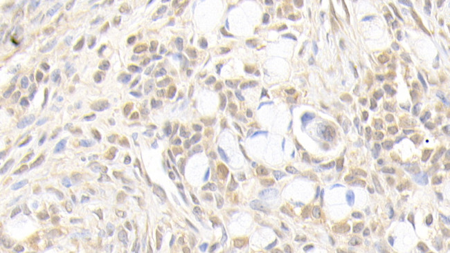 AFP Antibody in Immunohistochemistry (Paraffin) (IHC (P))