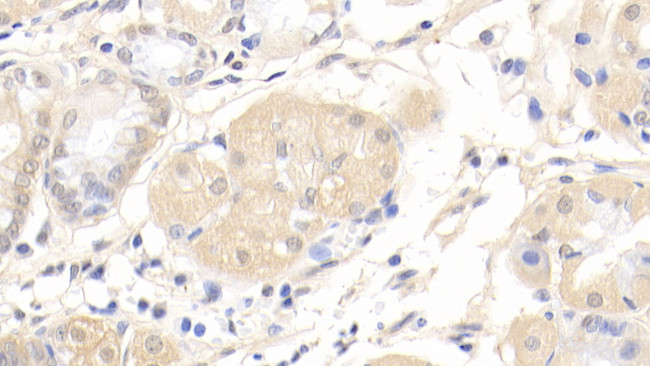 AFP Antibody in Immunohistochemistry (Paraffin) (IHC (P))