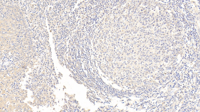 AFP Antibody in Immunohistochemistry (Paraffin) (IHC (P))