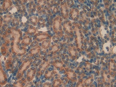 AHSP Antibody in Immunohistochemistry (Paraffin) (IHC (P))