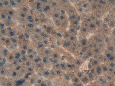 AHSP Antibody in Immunohistochemistry (Paraffin) (IHC (P))