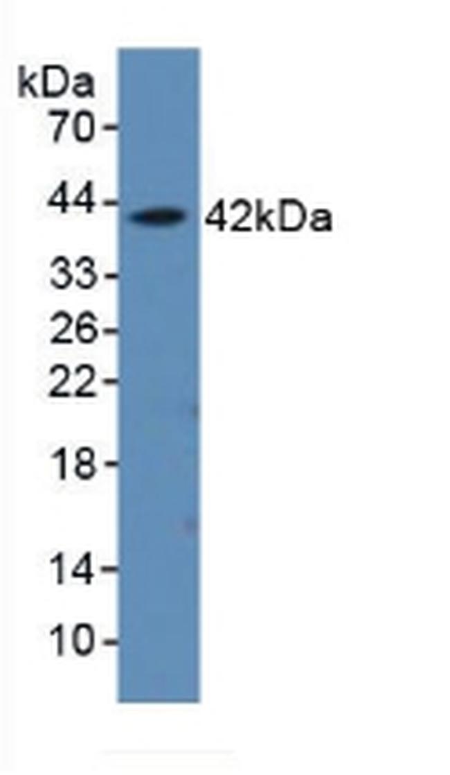 AHSP Antibody in Western Blot (WB)