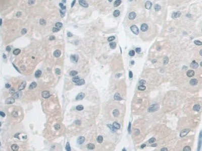 AUP1 Antibody in Immunohistochemistry (Paraffin) (IHC (P))