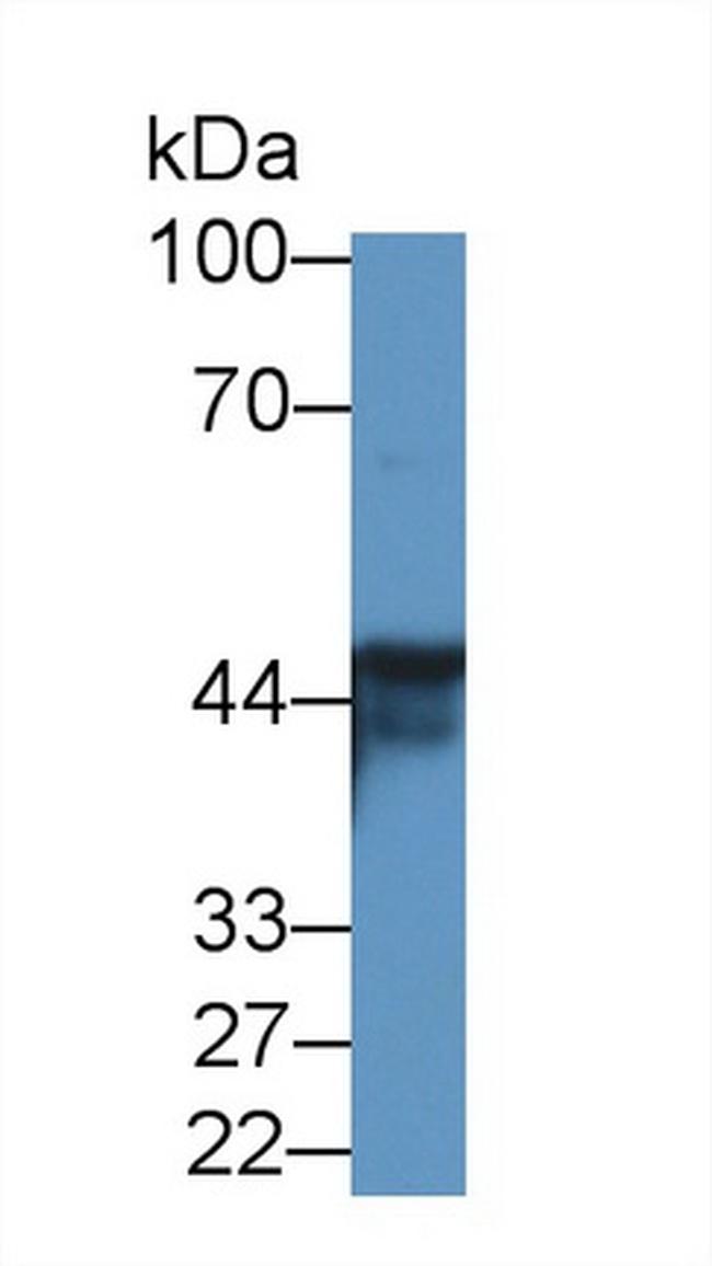 AUP1 Antibody in Western Blot (WB)