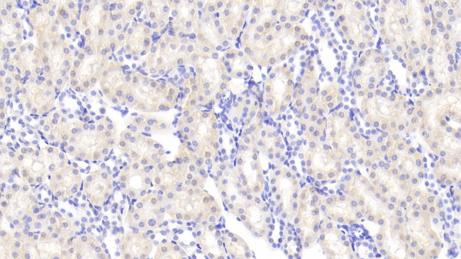 Angiogenin Antibody in Immunohistochemistry (Paraffin) (IHC (P))