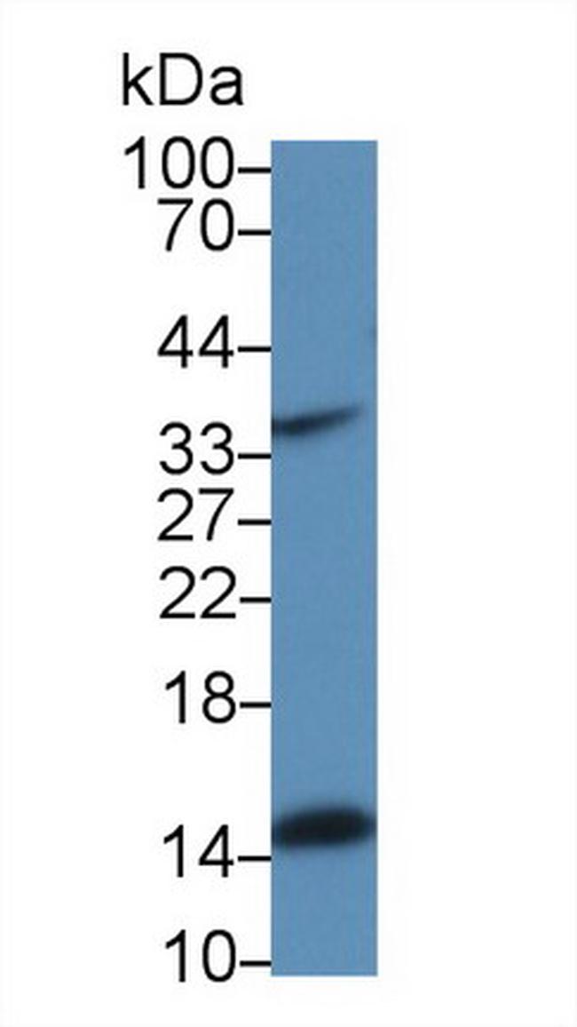 Angiogenin Antibody in Western Blot (WB)