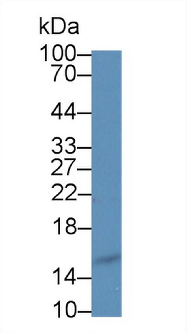 Angiogenin Antibody in Western Blot (WB)