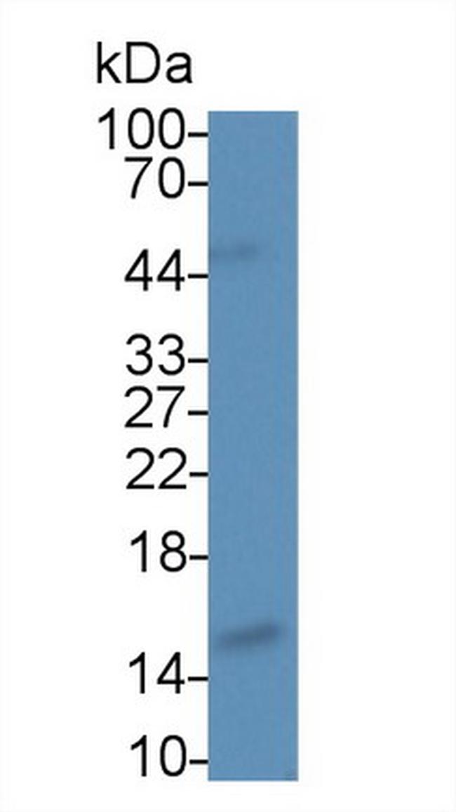 Angiogenin Antibody in Western Blot (WB)