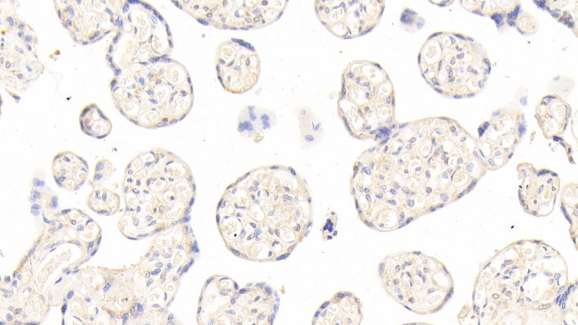 Angiopoietin 2 Antibody in Immunohistochemistry (Paraffin) (IHC (P))