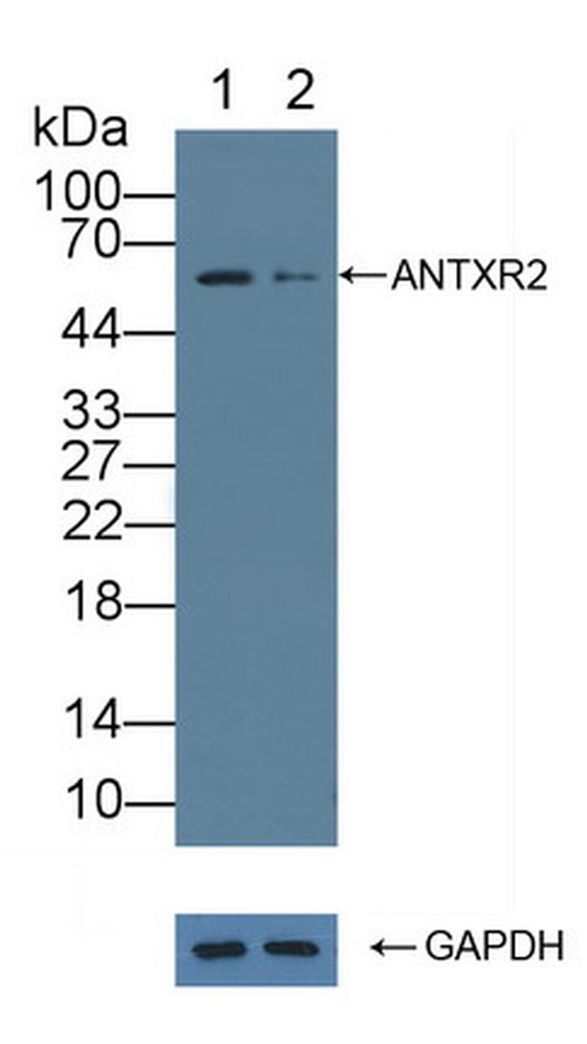ANTXR2 Antibody in Western Blot (WB)