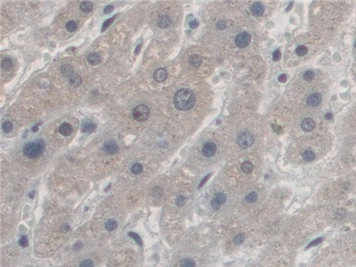 AZIN1 Antibody in Immunohistochemistry (Paraffin) (IHC (P))