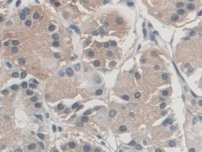 AZIN1 Antibody in Immunohistochemistry (Paraffin) (IHC (P))