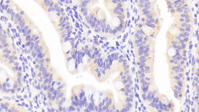 APOA4 Antibody in Immunohistochemistry (Paraffin) (IHC (P))