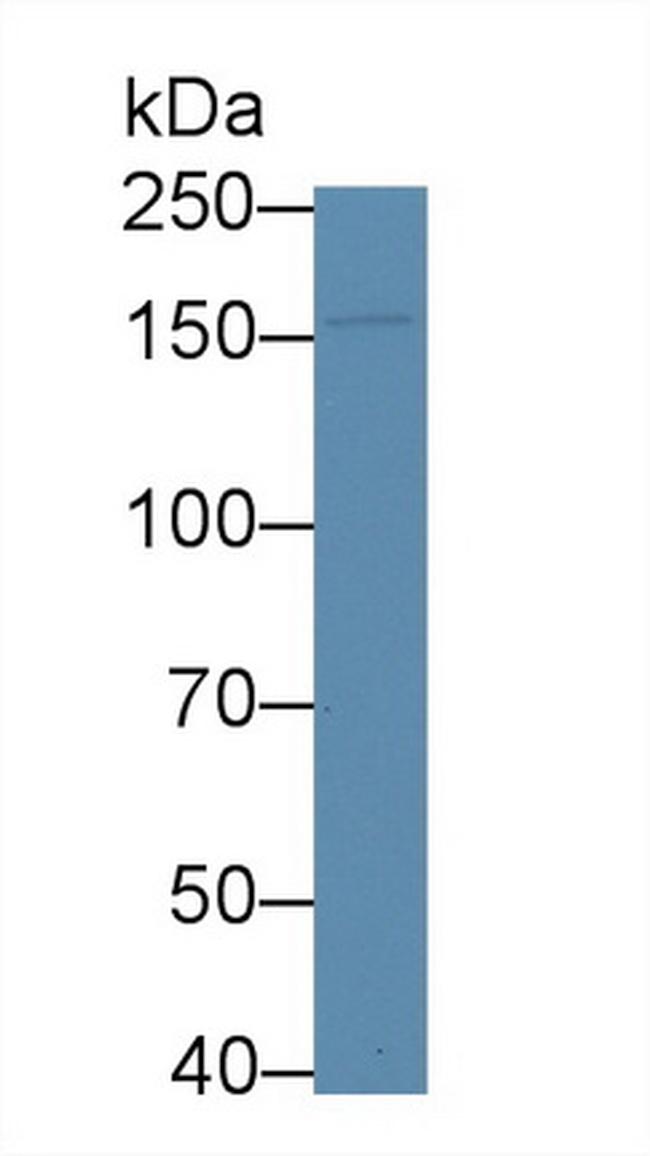 APOB Antibody in Western Blot (WB)