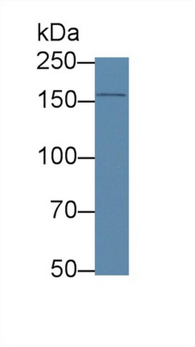 APOB Antibody in Western Blot (WB)