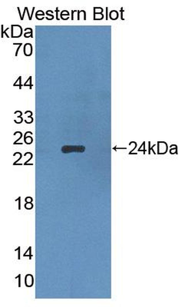 APOB Antibody in Western Blot (WB)