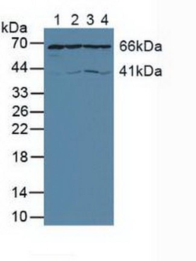 AIF Antibody in Western Blot (WB)