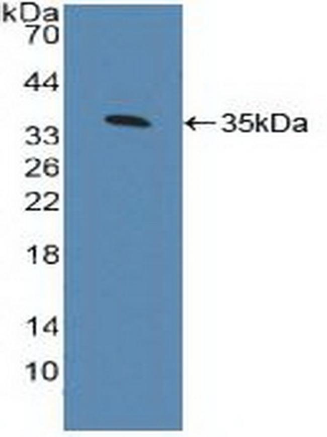 AHR Antibody in Western Blot (WB)