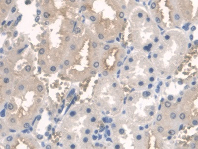 BMAL1 Antibody in Immunohistochemistry (Paraffin) (IHC (P))