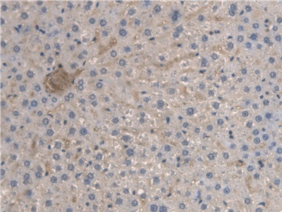 BMAL1 Antibody in Immunohistochemistry (Paraffin) (IHC (P))