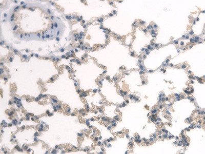 BMAL1 Antibody in Immunohistochemistry (Paraffin) (IHC (P))