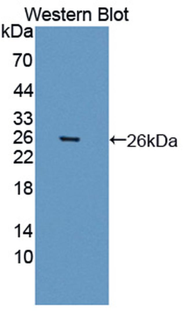 BMAL1 Antibody in Western Blot (WB)