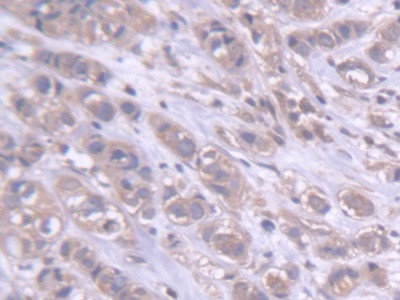 DARS Antibody in Immunohistochemistry (Paraffin) (IHC (P))