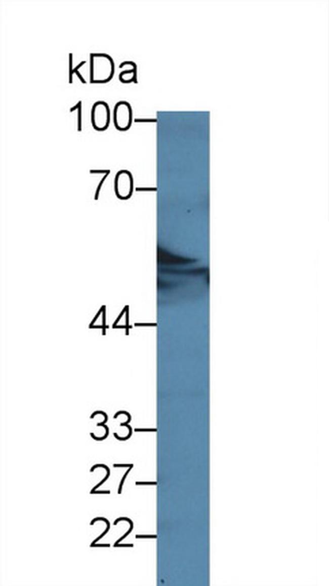 DARS Antibody in Western Blot (WB)