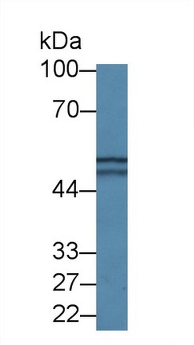 DARS Antibody in Western Blot (WB)